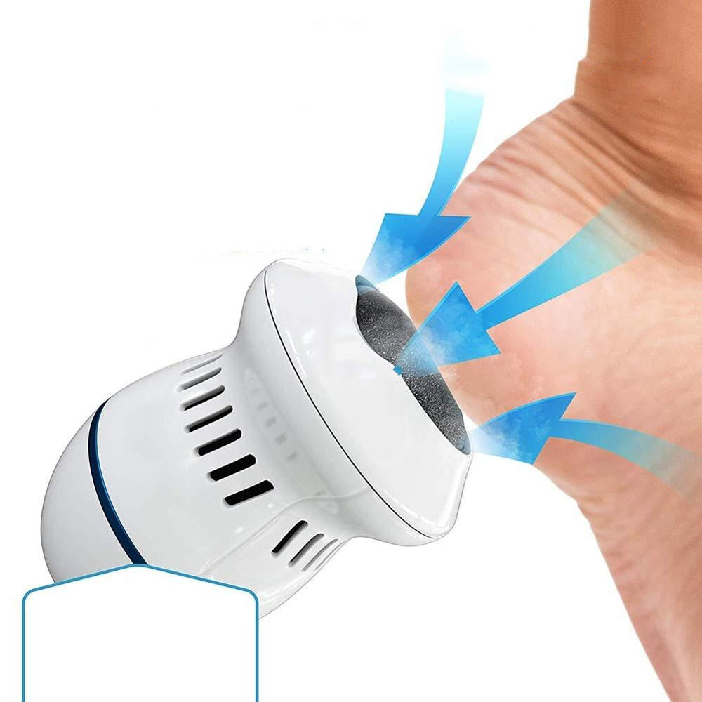 CeroCallos® Quita Callos